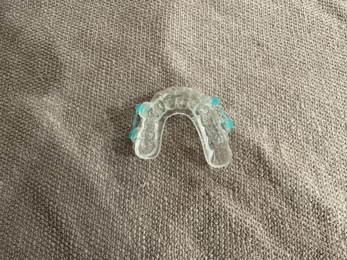 Customer photo review of Sleep Apnea Appliance, Clear Retainer, Includes Connectors $65 value