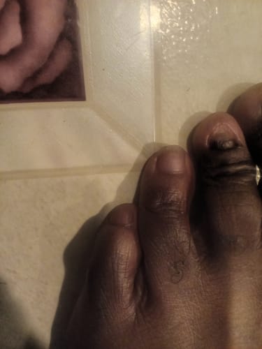 Customer photo review of Kerassentials Nail Serum