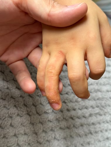 Customer photo review of Organic Barrier Balm