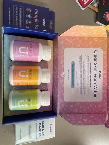 Customer photo review of Starter Acne Program™