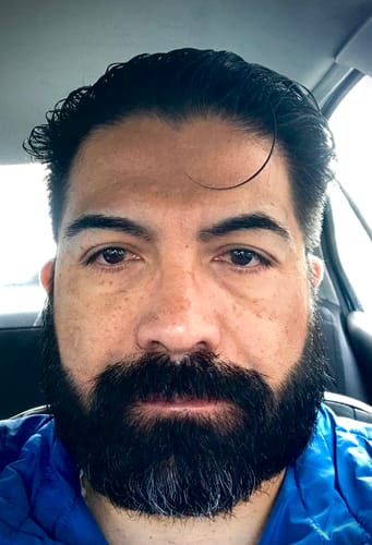 Customer photo review of Aceite y Shampoo Para Barba · Paquete 2 Piezas