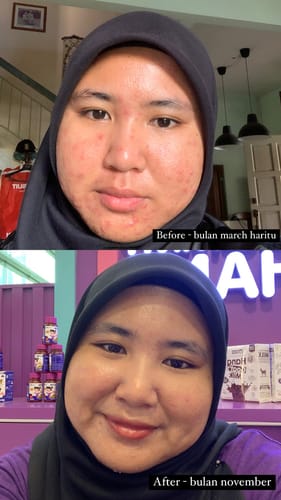 Customer photo review of Soothing Facial Cleanser