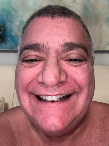 Customer photo review of InstantPurple™ Color Corrector with nHAp