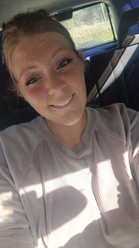 Customer photo review of Spare Veneers