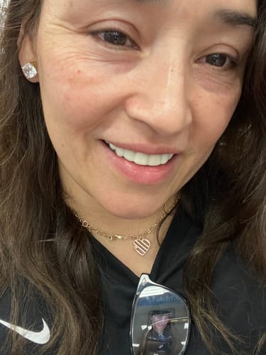 Customer photo review of Weekly Payment Plan - Pop On Veneers with At Home Impression Kit