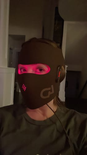 Customer photo review of JOVS 4D Laser Light Therapy Mask