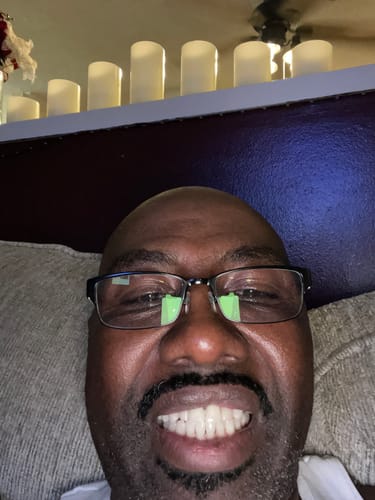Customer photo review of Dental Impression Trays