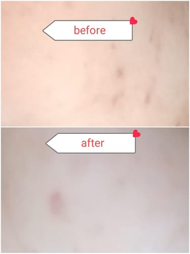 Junaid B. review of Pigmentation Bundle: Face Wash & Melasma Cream Duo image 1 out of 1