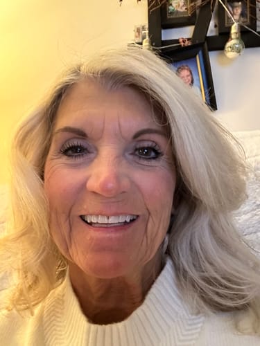 Customer photo review of Anti-Aging treatment