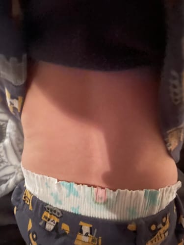 Customer photo review of All Over Ointment Eczema Treatment