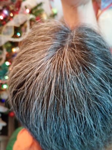 Customer photo review of Acondicionador Anticaída