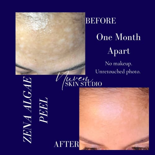 Customer photo review of Zena Natural Algae Peel Course + Kit