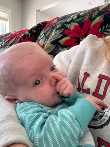 Customer photo review of Bye-Bye Cradle Cap