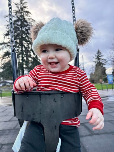 Customer photo review of All Over Ointment Eczema Treatment