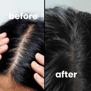 Customer photo review of Laser Hair Growth Therapy Pro