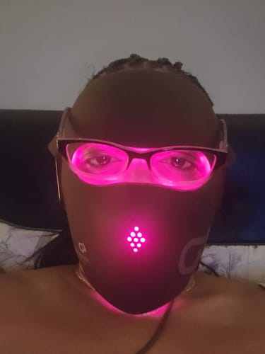 Customer photo review of JOVS 4D Laser Light Therapy Mask