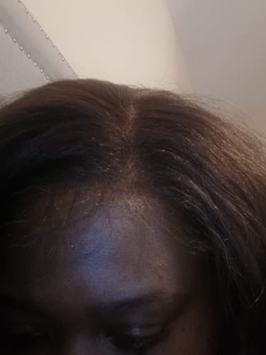Customer photo review of Outre Perfect Hairline Synthetic Hair 13X4 HD Lace Front Wig - IMANI