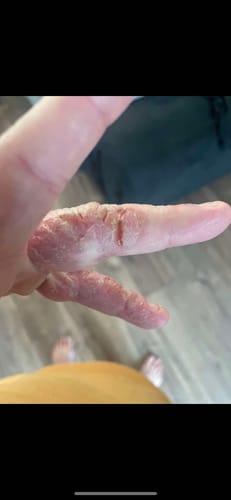 Customer photo review of Head to Toe Bundle | Body & Face Tallow