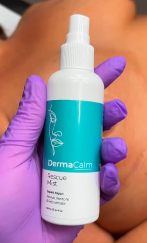 Customer photo review of Rescue Mist Mini (30ml) - Discounted Bulk Purchase