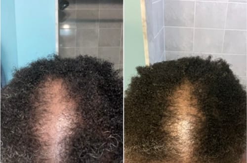 Customer photo review of Flowering Hair Serum