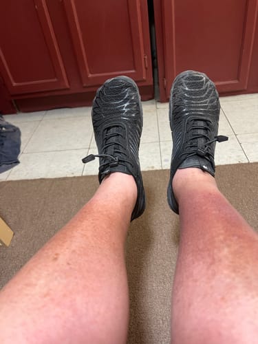 Customer photo review of Lorax Pro – All-Day Comfort & Pain-Free Barefoot Shoes (Unisex)