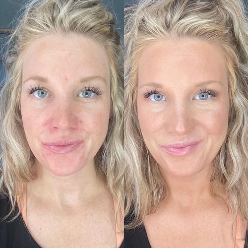 Customer photo review of Nuvee® Changing Foundation