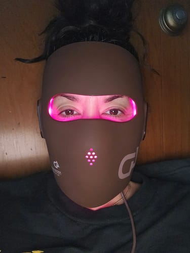 Customer photo review of JOVS 4D Laser Light Therapy Mask