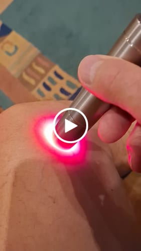 Customer video review of ClinicRed Fototerápiás Eszköz