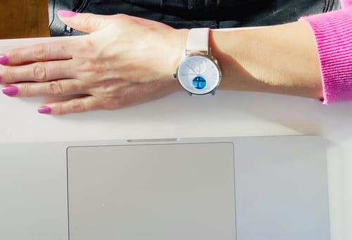 Kundenbewertung mit Foto zu Withings ScanWatch