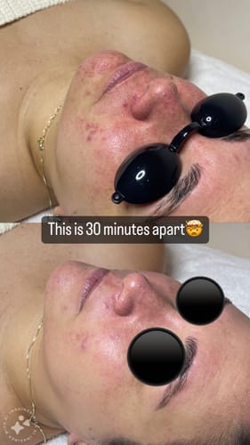 Customer photo review of The CryoPeptide 20 Pack