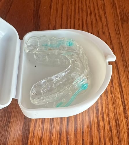 Customer photo review of Dental Impression Trays
