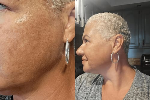 Customer photo review of Noirwild™ Turmeric Soap