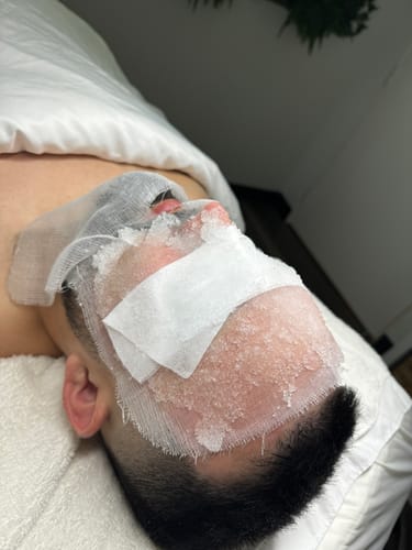 Customer photo review of KrX Cryofacial Caps