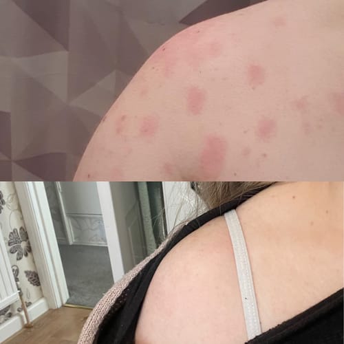 Customer photo review of Multi Strain Biotic