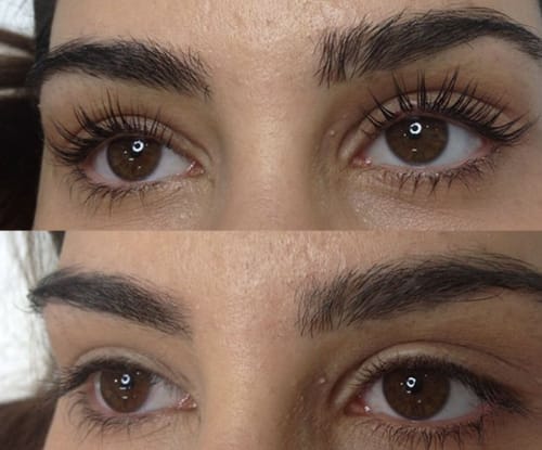 Customer photo review of SER DE CREȘTERE A GENELOR