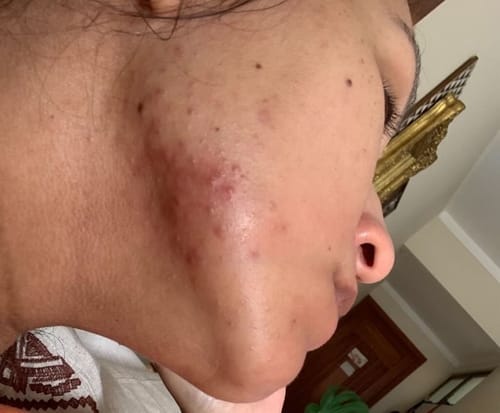 Customer photo review of Solução Niacinamida