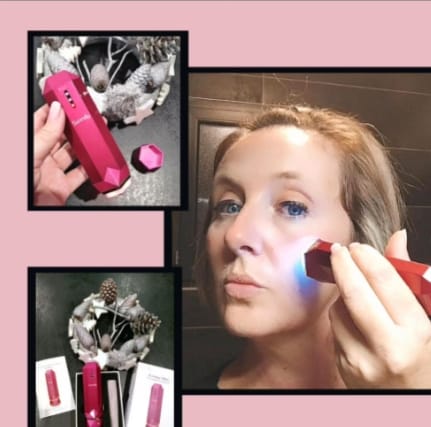 Customer photo review of SUNMAY VSkin Radio Frequency & EMS Technology 2 in 1 Face Lift Device
