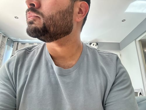 Customer photo review of Aceite y Shampoo Para Barba - Paquete 2 Piezas