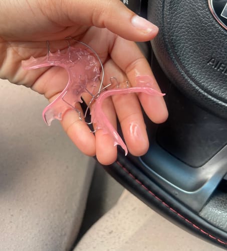 Customer photo review of Dental Impression Trays