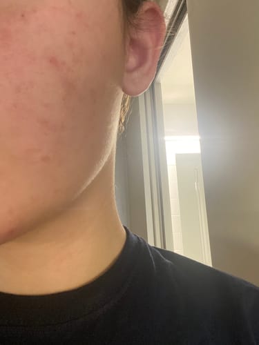 Customer photo review of Radiance Powder