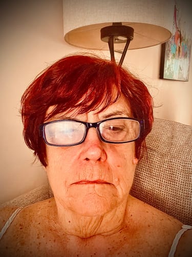 Customer photo review of SEA BUCKTHORN SERUM
