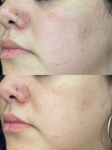 Customer photo review of KrX Green Sea Peel