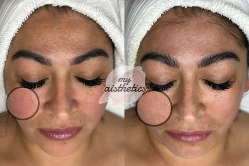 Customer photo review of O’Melon Omega Green