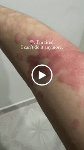 Customer video review of Multi Strain Biotic