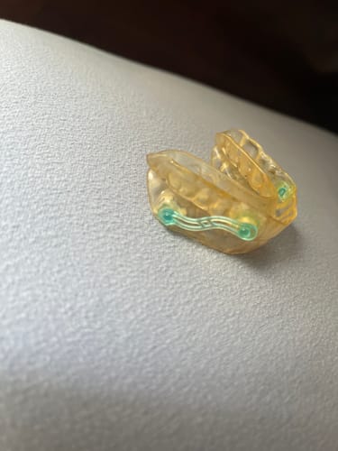 Customer photo review of Sleep Apnea Appliance Connectors