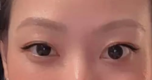 Customer photo review of Clalen iris (40pcs) 1Day G.DIA 13.3mm