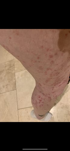 Customer photo review of Multi Strain Biotic