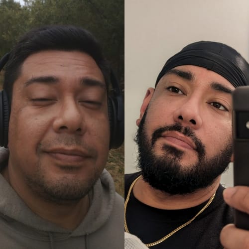 Customer photo review of 12.5% Minoxidil Extra Strength Topical Solution USP for Men.