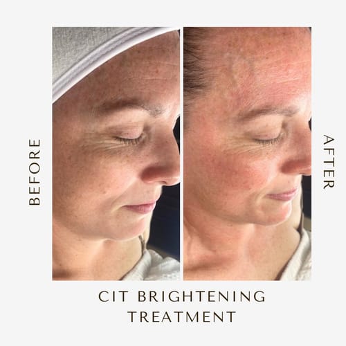 Customer photo review of Dermathod Derma Level 345 Radiance Ampoule