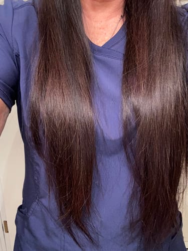 Customer photo review of Hair Glow™